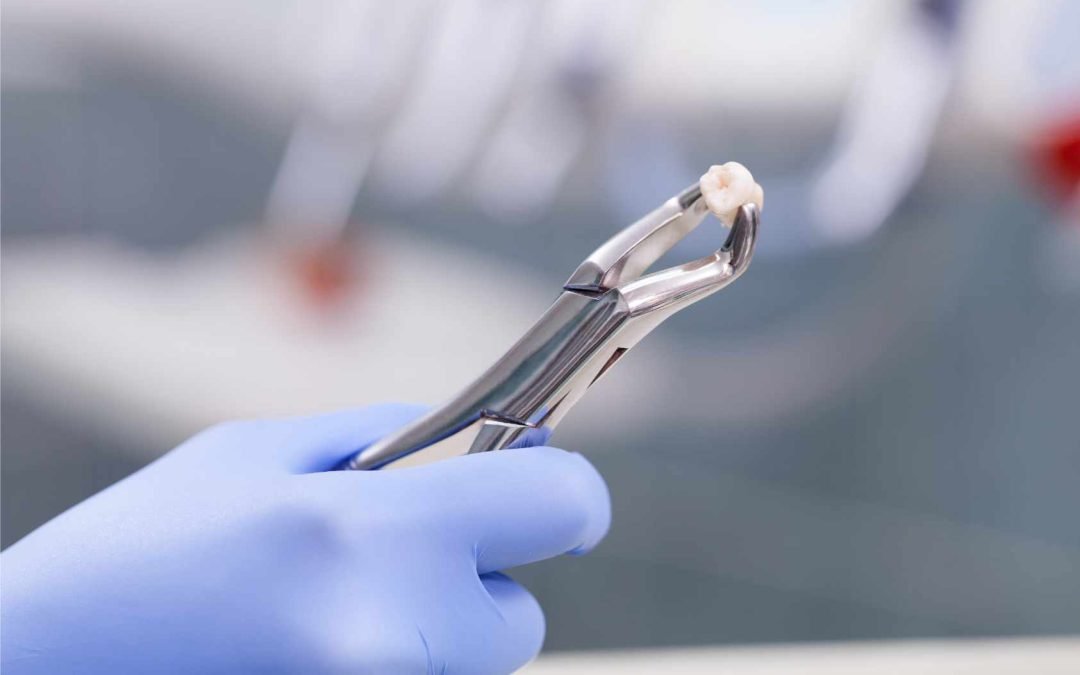 Dental Bridges vs. Dental Implants: Finding Your Best Tooth Replacement Option