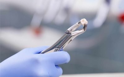 Dental Bridges vs. Dental Implants: Finding Your Best Tooth Replacement Option