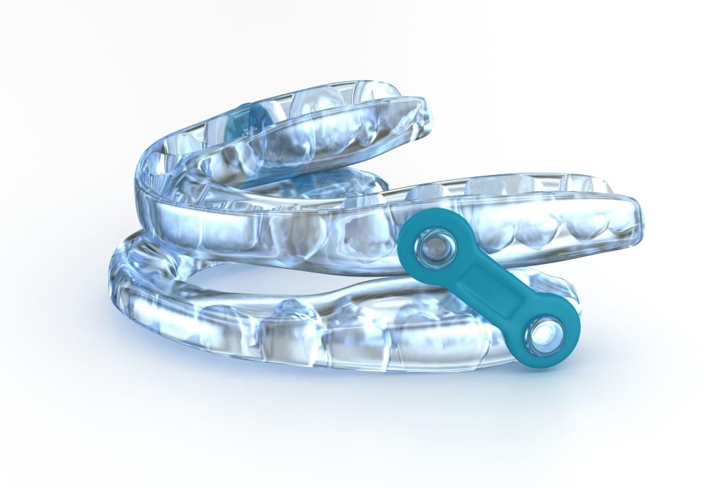 Mandibular Advancement Devices