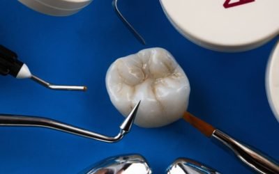 Everything You Need to Know About Dental Crowns