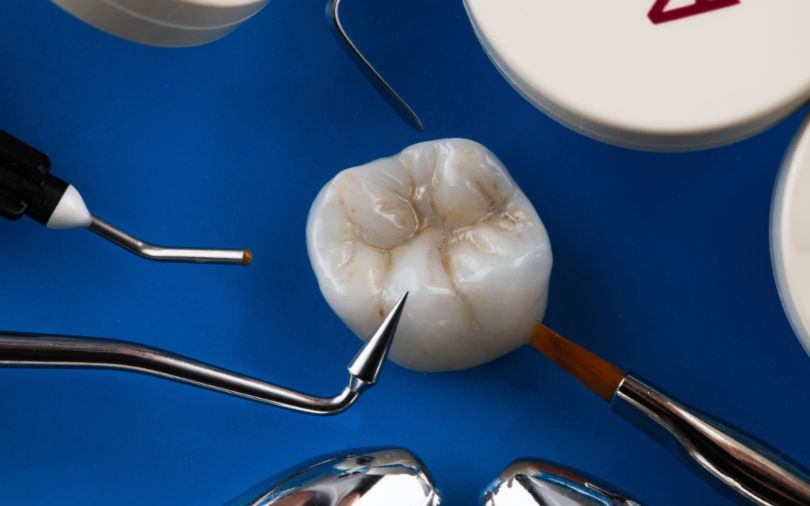 Everything You Need to Know About Dental Crowns