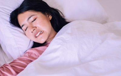 Tooth Grinding (Bruxism): Causes, Effects, and Solutions