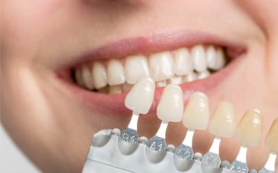 Porcelain Veneers vs. Composite Veneers: Which is Right for You?
