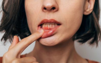 Healthy Gums: The Importance of Deep Cleaning