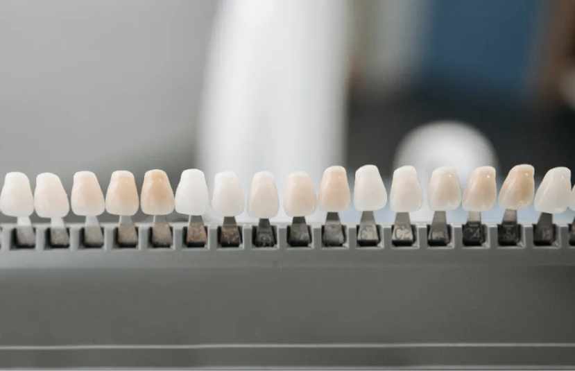 dental crowns