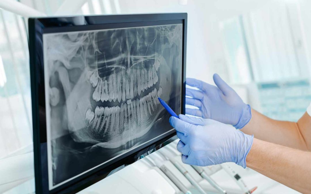 St. Cloud Smiles, Transformed by Technology: Exploring the Advantages of Digital Dentistry