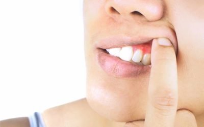 Protect Your Gums in St. Cloud: Understanding Gum Disease – Causes, Symptoms, and Treatment