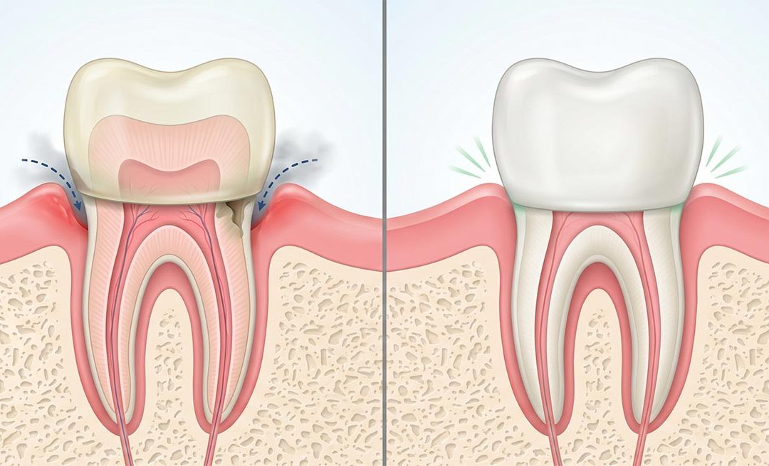 Solutions for Failed Dentistry in St. Cloud, MN
