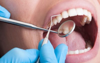 The Importance of Regular Teeth Cleanings