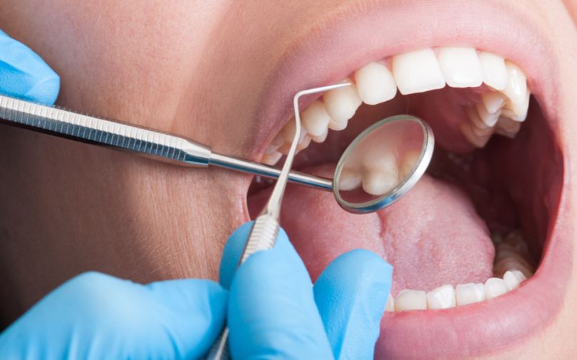 The Importance of Regular Teeth Cleanings