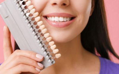 Veneers: What Are They, and How Do They Work?